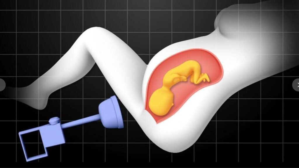【ABC特集】生まれて半日で息を引き取った息子　“吸引分娩”に潜むリスク　出産死亡事故の裁判を通じて「知ってほしい」両親の思い