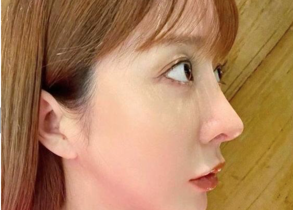 エンリケ　7ヶ所の整形２週間後公開→ファン「矢田亜希子さんかと」に返信「嬉しすぎる」７つの手術